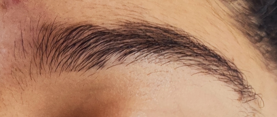 Sobrancelha antes do atendimento, registro de 17 de setembro